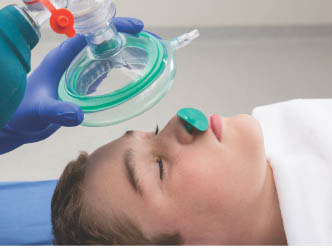 Latex Free Robertazzi Nasopharyngeal Airway - Image 2