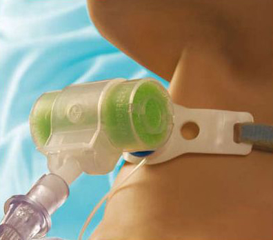 Hydro-Trach T HME with Swivel Connector - Image 2