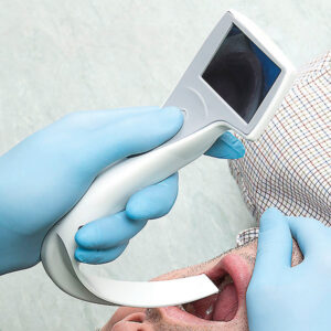 i-View™ Video Laryngoscope