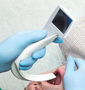 i-View™ Video Laryngoscope