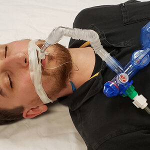 Go2Vent Single Patient Use Gas Operated Ventilator