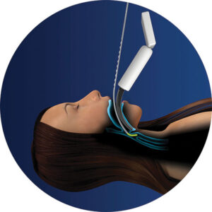 Flexible Tip Bougie