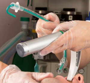 InterForm Intubation Stylette